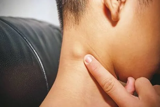 HEAD & NECK LUMPS