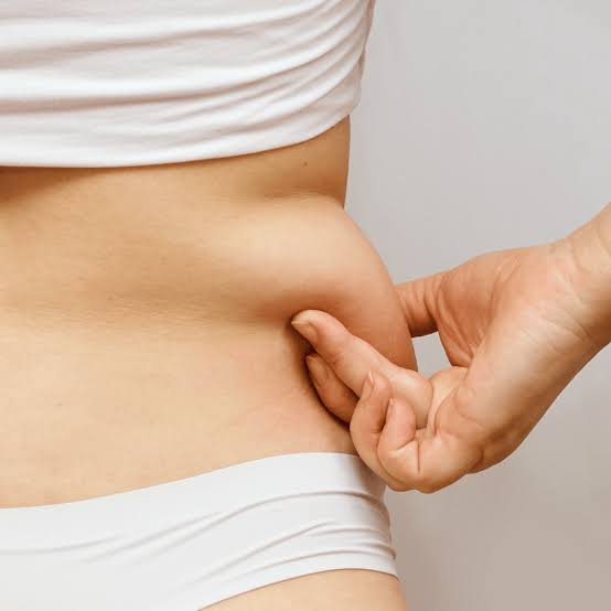 FAT FREEZING - CRYOLIPOLYSIS